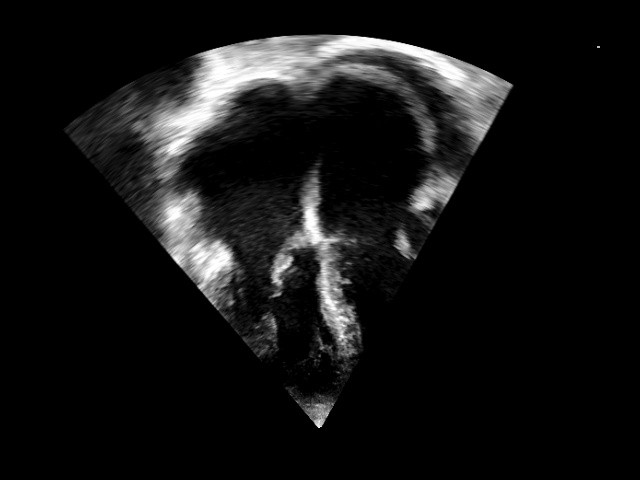 cardiac ultrasound image from CardiacNet
