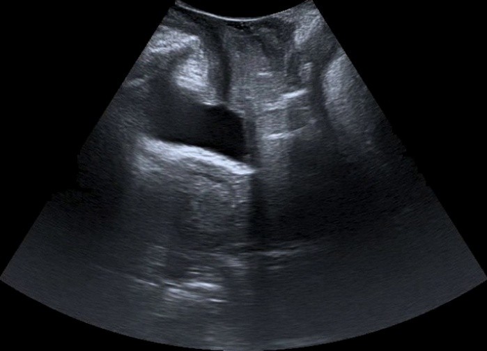 pelvic floor ultrasound image from PFUS