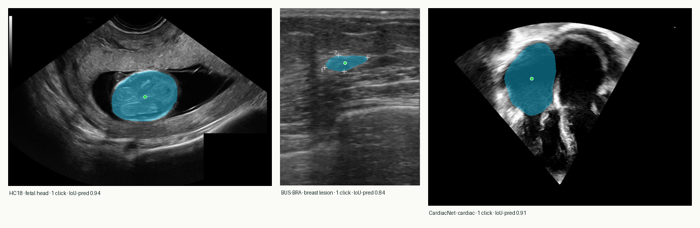 Three SonoBase one-click predictions: fetal head (HC18), breast lesion (BUS-BRA) and cardiac chambers (CardiacNet), each with the clicked point and the predicted mask overlay.