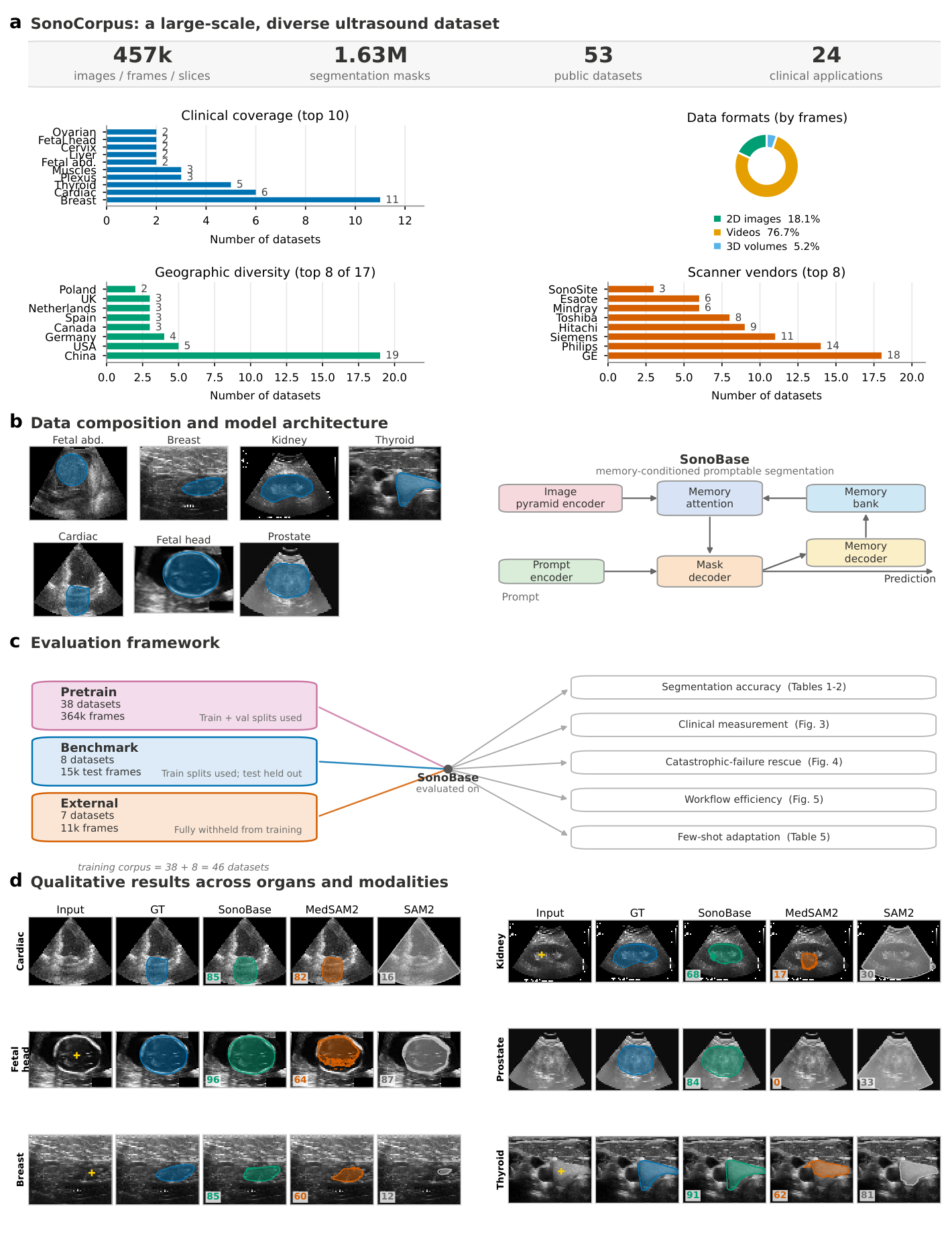 SonoCorpus composition, SonoBase architecture, evaluation tiers, and segmentation examples across organs.
